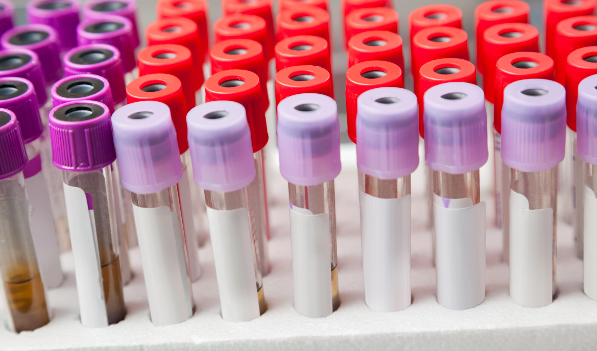 rack of specimen test tubes with blank labels