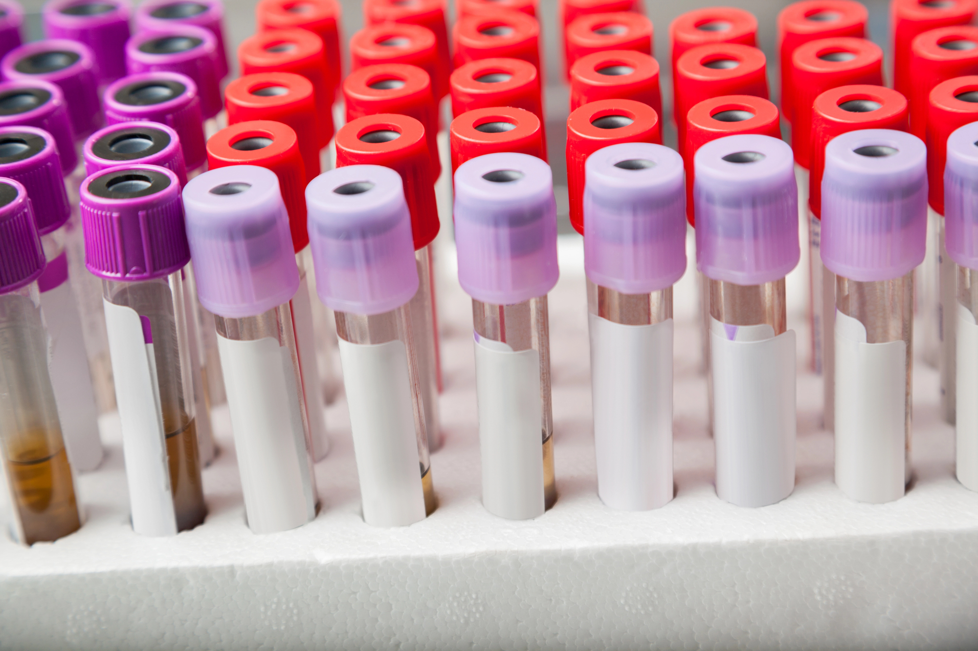 rack of specimen test tubes with blank labels