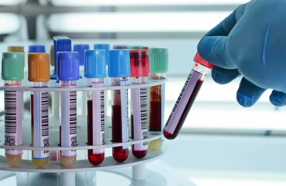 gloved hand placing a blood sample vial in holder